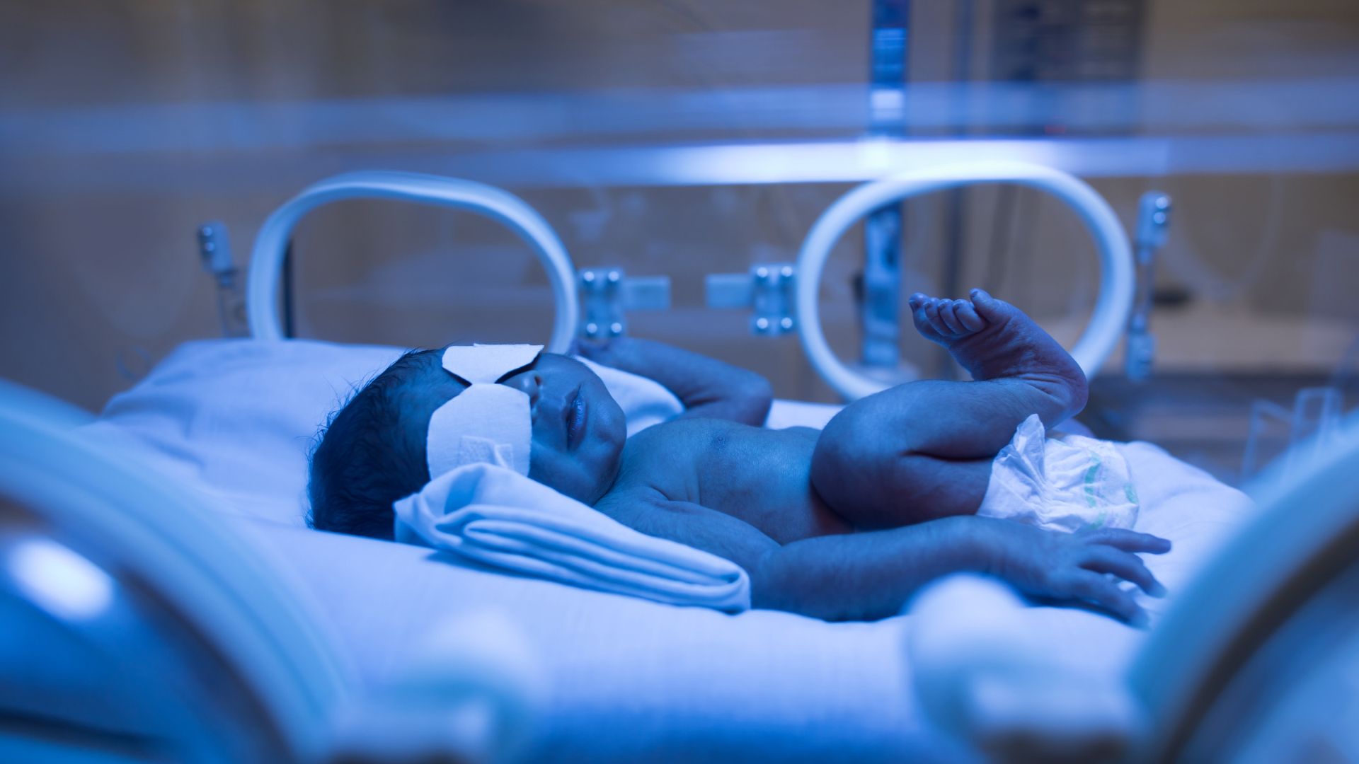 Everything you need to know about jaundice in newborn
