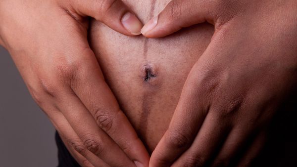 Linea Nigra - a dark line that stretches across the abdomen during pregnancy