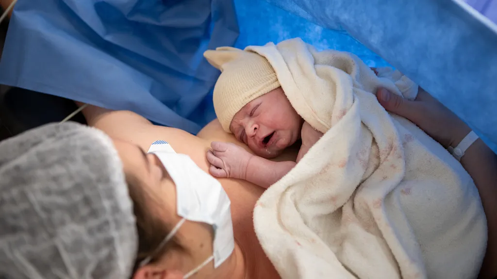 Doula at a Caesarean – extra support before, during and after birth