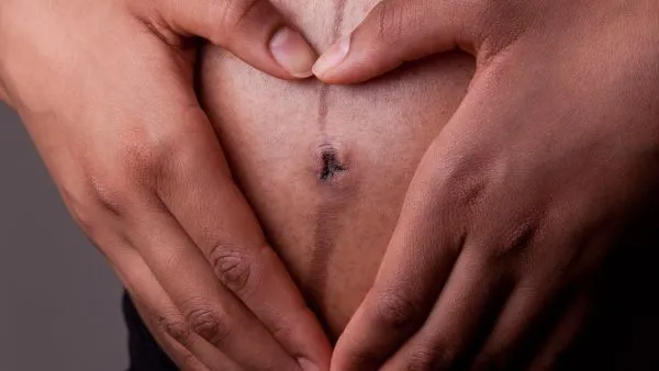 Linea Nigra - en mörk linje som sträcker sig över magen under graviditeten