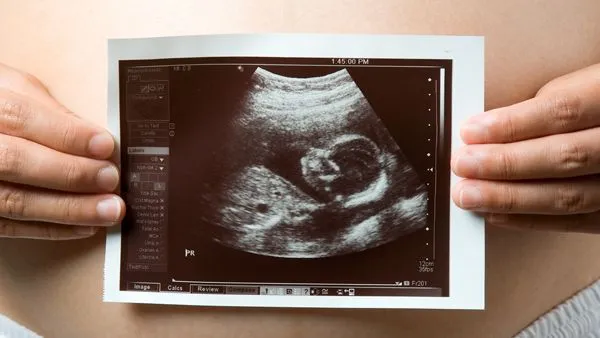 Onko aikaa rutiiniultraäänitutkimukseen? Kaikki odottamastasi tutkimuksesta